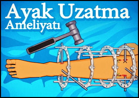 Ayak Uzatma Ameliyatı - Uzman doktor olarak ayak uzatma ameliyatını başarıyla tamamla