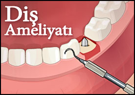 Uzman doktor olarak diş ameliyatını başarıyla tamamla